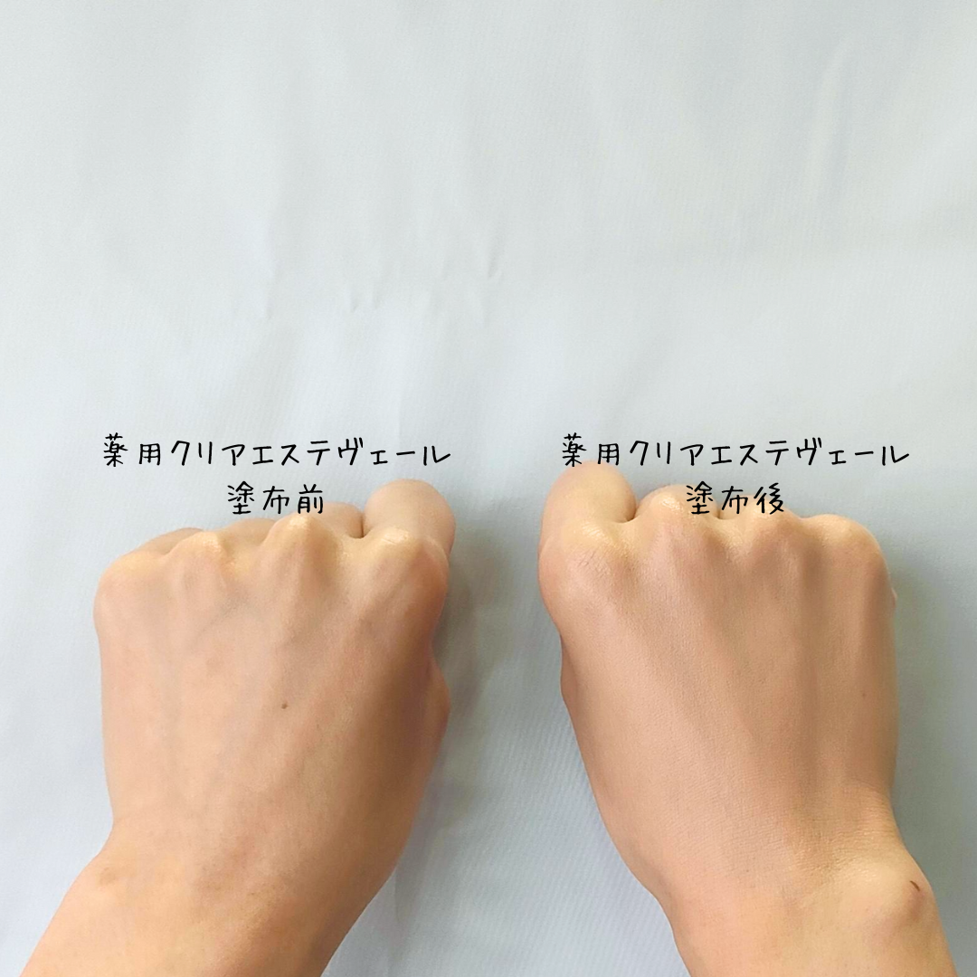 薬用クリアエステヴェール塗布前　塗布後①